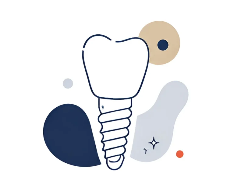 Implantalogía dental cadiz